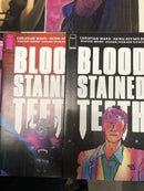 Blood Stained Teeth Set Issues